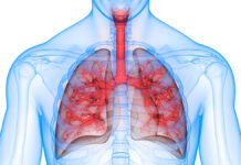 Sindrome del QT lungo (LQT2): un farmaco per la fibrosi cistica apre alla medicina di precisione cardiologica